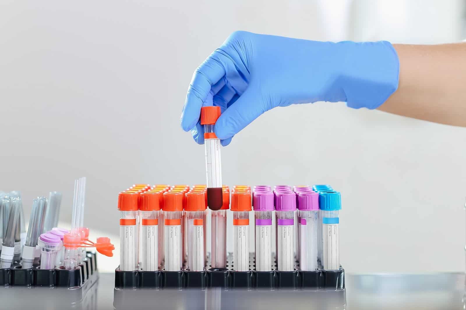 blood lab test tubes